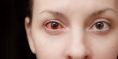 أعراض مرضية تدل على إصابتك بأكثر أمراض العيون انتشاراً