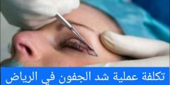 تكلفة عملية شد الجفون في الرياض Blepharoplasty
