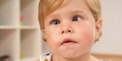 علاج حول الأطفال strabismus surgery