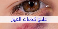 اسباب كدمات العين eye health services