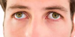 علاج رأرأة العين nystagmus treatment