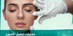 عمليات تجميل العيون Eye plastic surgery