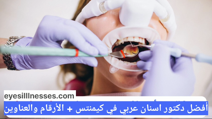 أفضل دكتور اسنان عربي في كيمنتس + الأرقام والعناوين