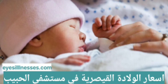 اسعار الولادة القيصرية في مستشفى الحبيب 2023