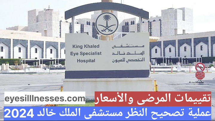 عملية تصحيح النظر مستشفى الملك خالد 2024
